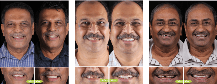 Patient results after treatment